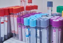 Photo of Происшествия и медицина: анализ взаимосвязи