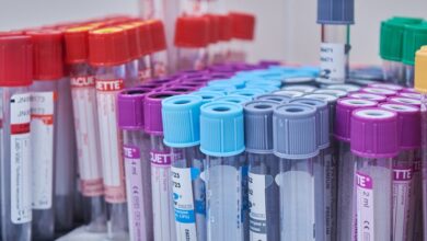 Photo of Происшествия и медицина: анализ взаимосвязи